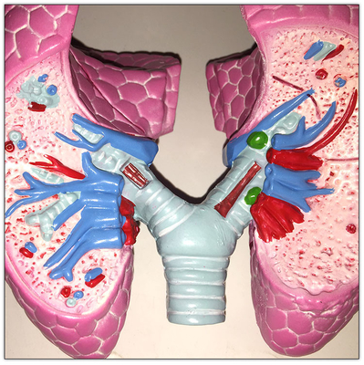 Modèle en plastique 19x13x17cm de étude viscéral d'organes de corps humain de poumon de COPD